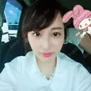 二重埋没 / 目頭切開 / 鼻尖形成（切開） / 鼻中隔延長（切開） / 軟骨移植 / ヒアルロン酸注入（鼻） / ヒアルロン酸注入（あご） 湘南美容クリニック 新潟院 DAY 90 サムネイル用