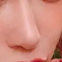 隆鼻術 / 鼻中隔延長（切開） 牧野皮膚科形成外科内科医院 美容外科・形成外科・抗加齢医学外来 DAY 274 サムネイル用