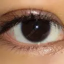 二重埋没 / 眼瞼下垂（切開） アリナガ美容外科 DAY 10 サムネイル用