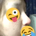 隆鼻術 / 鼻中隔延長（切開） 牧野皮膚科形成外科内科医院 美容外科・形成外科・抗加齢医学外来 DAY 191 サムネイル用