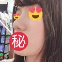 隆鼻術 / 小鼻縮小（切開） / 鼻修正 ルラ美容クリニック 高田馬場院 DAY 37 サムネイル用
