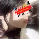 バッカルファット除去 / 脂肪吸引（顔） / ヒアルロン酸注入（あご） / ボトックス（エラ・小顔） / ボトックス（ふくらはぎ） / ボトックス（肩） エートップ美容整形外科 AFTER サムネイル用