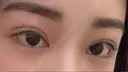 二重埋没 / 眼瞼下垂（切開） / 目尻切開 / 蒙古ひだ形成 / タレ目形成・グラマラスライン（切開） POP美容整形クリニック AFTER サムネイル用