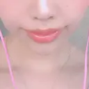 人中短縮 / 口角挙上 清潭女神美容外科 AFTER サムネイル用