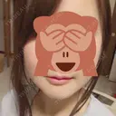 骨切り（あご） / その他（輪郭） マックスファクス銀座クリニック DAY 28 サムネイル用