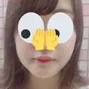 骨切り（あご） / その他（輪郭） マックスファクス銀座クリニック AFTER サムネイル用