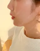 クマ治療 / 額を丸く / 脂肪吸引（脚） / レディエッセ注入（鼻） THE CLINIC（ザ・クリニック） 東京院 AFTER サムネイル用