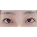 二重埋没 城本クリニック 姫路院 DAY 19 サムネイル用