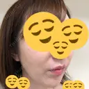 肌ヒアルロン酸注入（たるみ・シワ改善） / ヒアルロン酸注入（あご） ジョウクリニック 松山院 DAY 0 サムネイル用