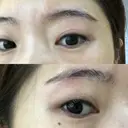 眉下切開 ビクアスクリニック DAY 57 サムネイル用