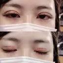 二重埋没 品川美容外科 仙台院 DAY 0 サムネイル用