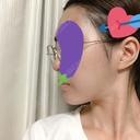 脂肪吸引（顔） / ボトックス（あご） / ヒアルロン酸注入（あご） / ボトックス（エラ・小顔） プチパーティー医院 DAY 74 サムネイル用