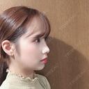 二重埋没 / 骨切り（あご） / 骨削り（頬） / 軟骨移植 / 骨切幅寄せ バノバギ整形外科 AFTER サムネイル用