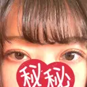 眼瞼下垂（切開） 札幌中央形成外科 DAY 35 サムネイル用