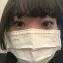 その他（目元） コムロクリニック 東京銀座院 DAY 0 サムネイル用