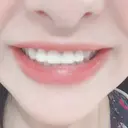 矯正（ワイヤー） / セラミック 東京美容外科 赤坂院 AFTER サムネイル用