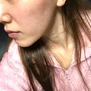 脂肪溶解注射（顔） / その他（肌） The-Clim産婦人科  DAY 18 サムネイル用