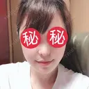 鼻中隔延長（切開） / 骨切り（あご） / 骨削り（エラ） / 軟骨移植 / 眉間プロテーゼ id（アイディ）美容外科 AFTER サムネイル用
