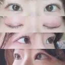 二重埋没 / 目頭切開 かめい美容クリニック宇都宮 DAY 159 サムネイル用