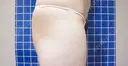 脂肪吸引（お尻） / ヒップアップ手術 / 脂肪溶解注射 UB CLINIC銀座 DAY 28 サムネイル用
