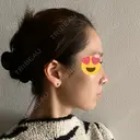 小鼻縮小（切開） / 糸リフト / 鼻尖縮小 / ヒアルロン酸注入（鼻） / ハイフ（顔） ヴェリテクリニック 大阪院 DAY 163 サムネイル用