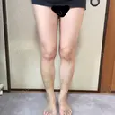 脂肪吸引（脚） / 肌ヒアルロン酸注入（たるみ・シワ改善） プチパーティー医院 DAY 25 サムネイル用