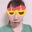 糸リフト / ヒアルロン酸注入（あご） / 脂肪溶解注射（顔） リエンジャン整形外科 江南店 AFTER サムネイル用