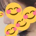 隆鼻術 / 鼻尖形成（切開） / 軟骨移植 HANABI整形外科 DAY 16 サムネイル用