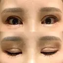 二重切開 / 目頭切開 / その他（目元） / 目尻切開 / タレ目形成・グラマラスライン（切開） id（アイディ）美容外科 AFTER サムネイル用