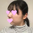 鼻中隔延長（切開） / 小鼻縮小（切開） / 軟骨移植 / 鼻尖縮小 / 鼻孔縁下降 / その他（鼻） 加美（GAMI）整形外科 DAY 29 サムネイル用