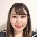 二重埋没 / バッカルファット除去 / 脂肪吸引（顔） / ヒアルロン酸注入（あご） / ボトックス（エラ・小顔） / 美容点滴・美容注射（美肌） エートップ美容整形外科 AFTER サムネイル用