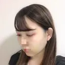 二重埋没 / バッカルファット除去 / 脂肪吸引（顔） / ヒアルロン酸注入（あご） / ボトックス（エラ・小顔） / 美容点滴・美容注射（美肌） エートップ美容整形外科 DAY 14 サムネイル用