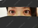 二重埋没 / 小鼻縮小（切開） / その他（鼻） / 骨切り（あご） / 軟骨移植 バノバギ整形外科 DAY 7 サムネイル用