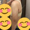 脂肪吸引（二の腕） 湘南美容クリニック 岡山院 DAY 42 サムネイル用