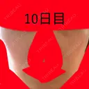 美肌レーザー / シミ取りレーザー / ルビーレーザー 銀座お肌の診療所 DAY 10 サムネイル用