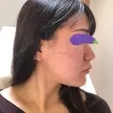 スレッドノーズ Beauty Clinic the GINZA DAY 0 サムネイル用