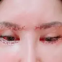 眼瞼下垂（切開） / クマ治療 / 目尻切開 / 下まぶたたるみ取り / 下まぶたの脂肪取り / タレ目形成・グラマラスライン（切開） / 眉下切開 id（アイディ）美容外科 DAY 6 サムネイル用