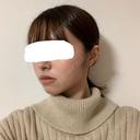 脂肪溶解注射（顔） 赤坂プレミアクリニック DAY 14 サムネイル用