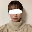 脂肪溶解注射（顔） 赤坂プレミアクリニック AFTER サムネイル用
