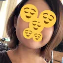 美肌レーザー / 再生医療 / シミ取りレーザー / 美白レーザー KM銀座クリニック DAY 7 サムネイル用