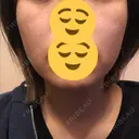 美肌レーザー / 再生医療 / シミ取りレーザー / 美白レーザー KM銀座クリニック DAY 9 サムネイル用