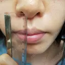 人中短縮 CLASSY 仙台美容外科・美容皮膚科 DAY 15 サムネイル用