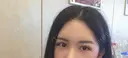 二重切開 / 目頭切開 / その他（目元） / 目尻切開 DI（ディアイ）整形外科 DAY 7 サムネイル用
