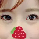 クマ治療 / 下まぶたたるみ取り / 下まぶたの脂肪取り ルラ美容クリニック 高田馬場院 DAY 31 サムネイル用