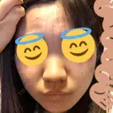 ピーリング（ニキビ・毛穴） / イオン導入 / エレクトロポレーション 湘南美容クリニック 宇都宮院 DAY 0 サムネイル用