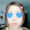 鼻中隔延長（切開） / 軟骨移植 / 鼻尖縮小 HANABI整形外科 DAY 96 サムネイル用