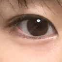 ヒアルロン酸注入（涙袋） the way（ザウェイ）整形外科 DAY 2 サムネイル用