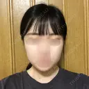 骨切り（あご） / 骨削り（エラ） / 骨削り（頬） RG整形外科（旧リオン整形外科） DAY 61 サムネイル用