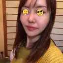 糸リフト / 骨切り（あご） / 骨削り（エラ） / 骨削り（頬） / 脂肪吸引（顔） / 輪郭修正 / 脂肪注入（額） / 脂肪注入（輪郭） / ハイフ（顔） GIRIN（ギリン）美容外科 DAY 103 サムネイル用