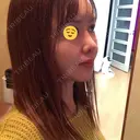 糸リフト / 骨切り（あご） / 骨削り（エラ） / 骨削り（頬） / 脂肪吸引（顔） / 輪郭修正 / 脂肪注入（額） / 脂肪注入（輪郭） / ハイフ（顔） GIRIN（ギリン）美容外科 DAY 103 サムネイル用